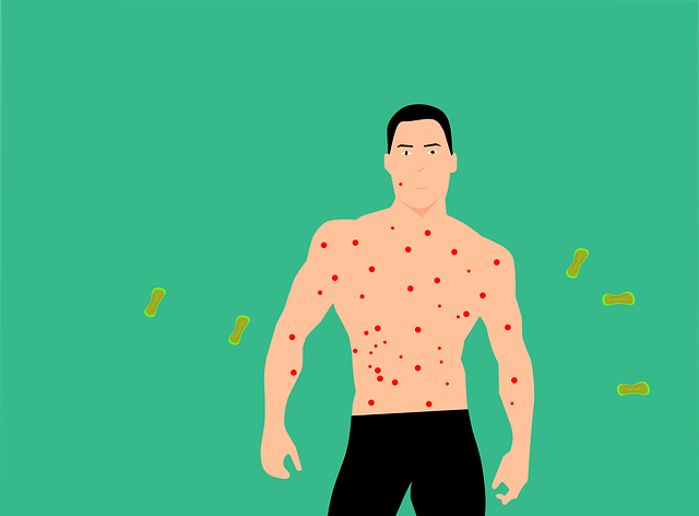 łysienie kiłowe wypadanie włosów